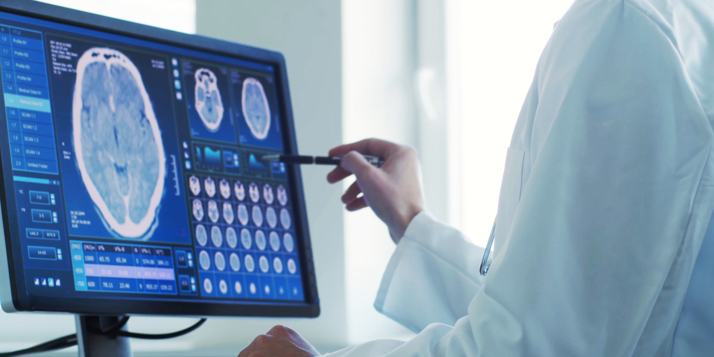 KI im Krankenhaus 2025 zeigt Chancen und Herausforderungen Bilderkennung im Krankenhaus durch KI